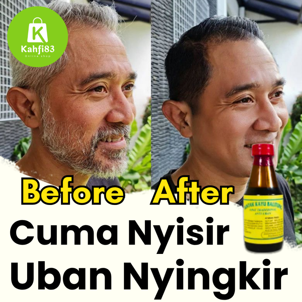(COD) Minyak Kayu Balitung Kalimantan Obat Penghilang Uban Penumbuh Rambut Botak dan Rontok Parah Pr
