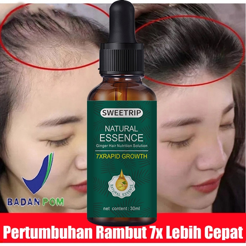 30ml Serum Penumbuh Rambut Penumbuh Rambut Natural Beard Oil Serum Penumbuh Dan Penebal Cepat Rambut