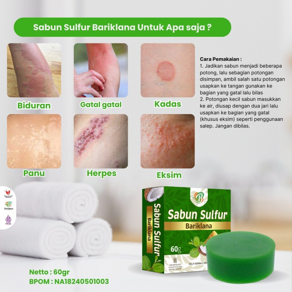 Sabun Gatal, Sabun Sulfur Bariklana, Panu, Kadas, Kurap, Eksim
