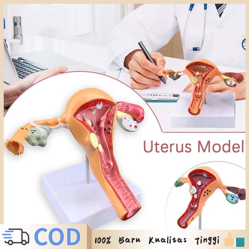 Manikin Uterus Ovary Model Patologis Uterus Alat Peraga Anatomi Anatomical Model Anatomy Uterus