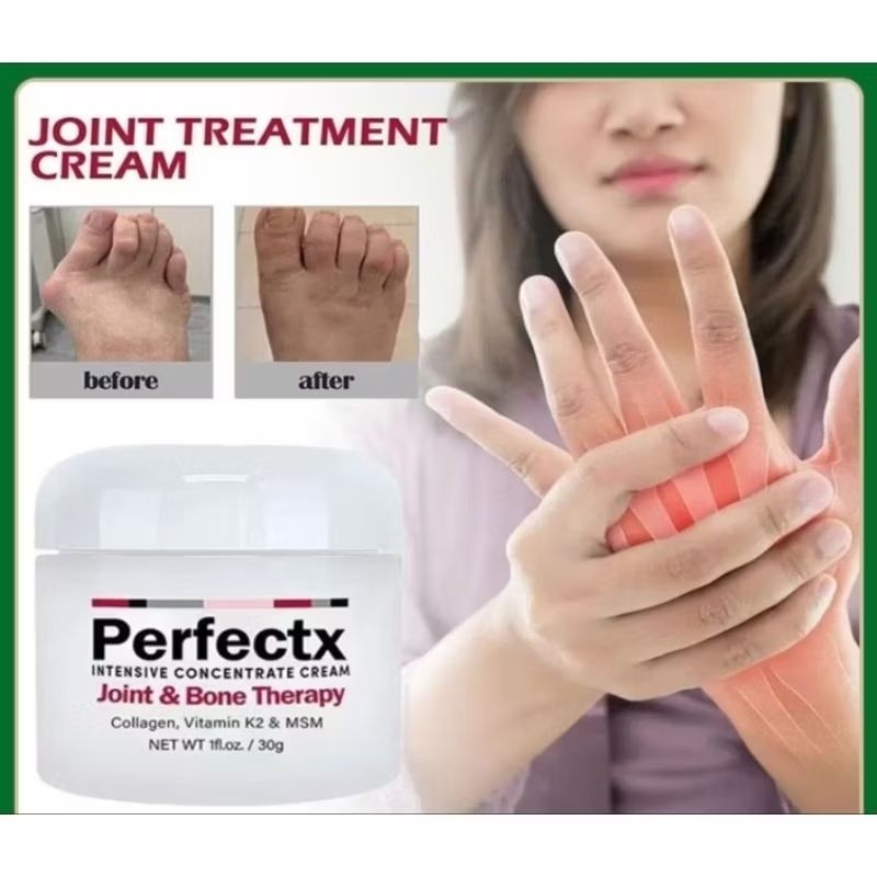 Cream Obat Asam Urat Nyeri Otot Sendi Paling Ampuh Original