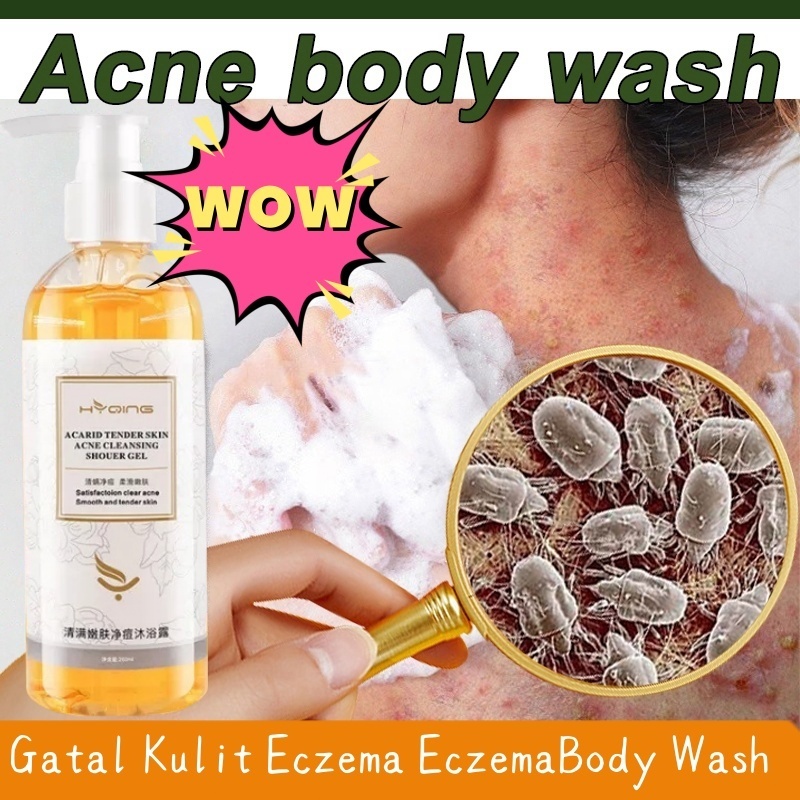 【COD ORI】Eczema Body Wash 260ML Sabun Eksim Pengobatan Psoriasis Eksim Kering Kurap Gatal Kulit Jamu