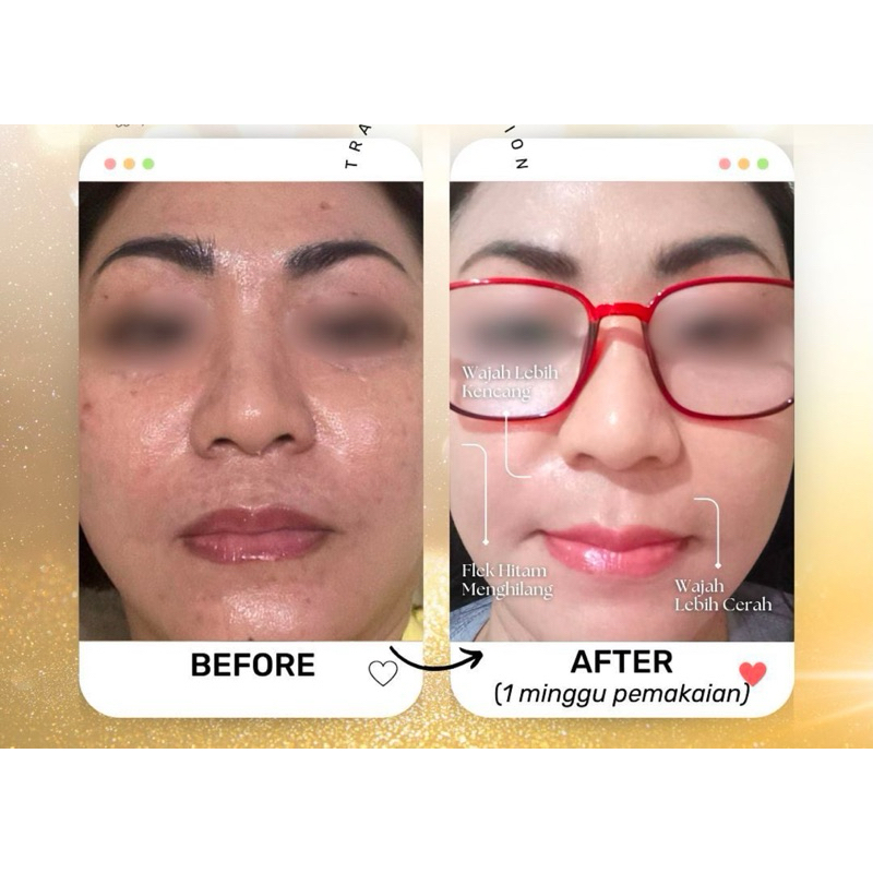 TERLARIS ECER TONER PEMBERSIH WAJAH MUKA SKIN BARRIER PELEMBAB NOMOR BPOM ADA IZIN EDAR INDONESIA AM