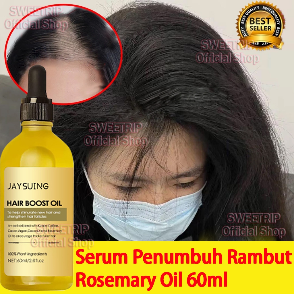 60ml Rosemary Oil Rambut Penumbuh Rambut Botak Penumbuh Rambut Botak Perawatan Rambut Rontok/ Alami 