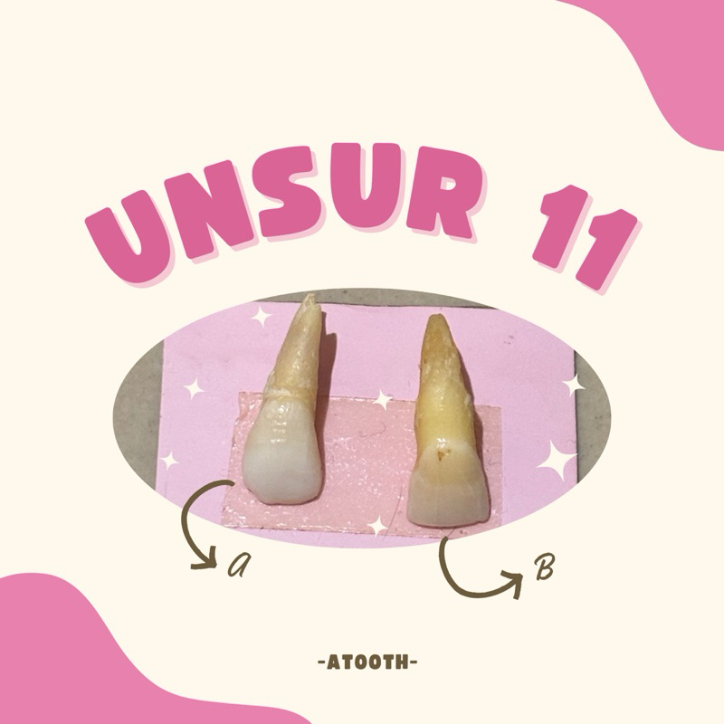 Unsur Gigi Praktikum 11