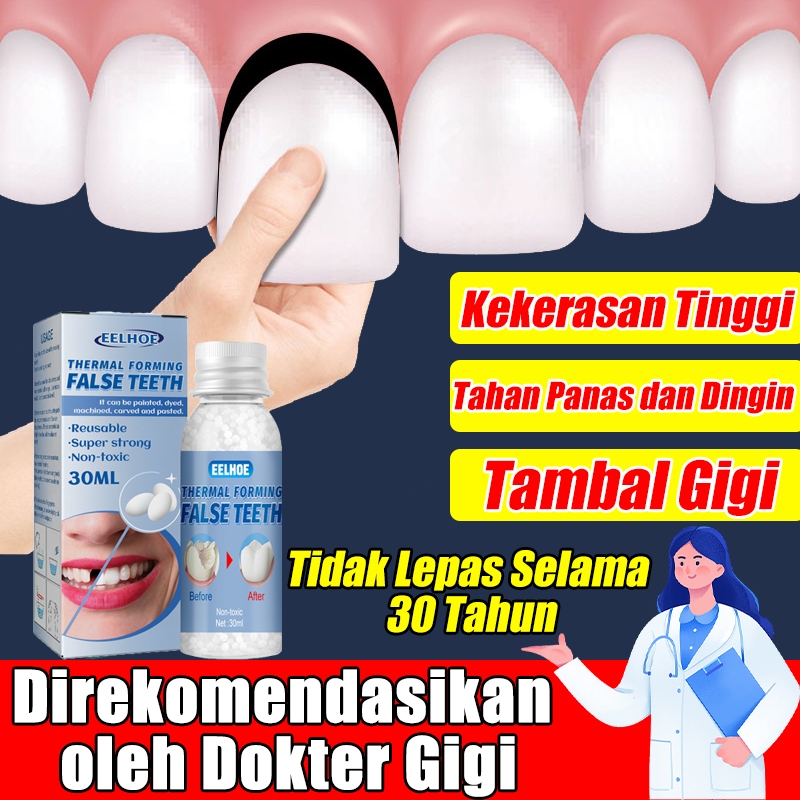 【Perbaikan Gigi Cepat】Penambal gigi berlubang Disarankan oleh Dokter gigi ompong gigi patah gigi bol