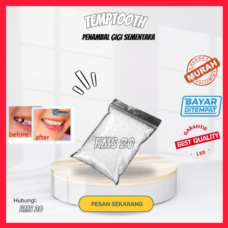 isi 250 butir gigi palsu sementara penambal gigi temptooth gigi palsu bahan alat tambal gigi sendiri