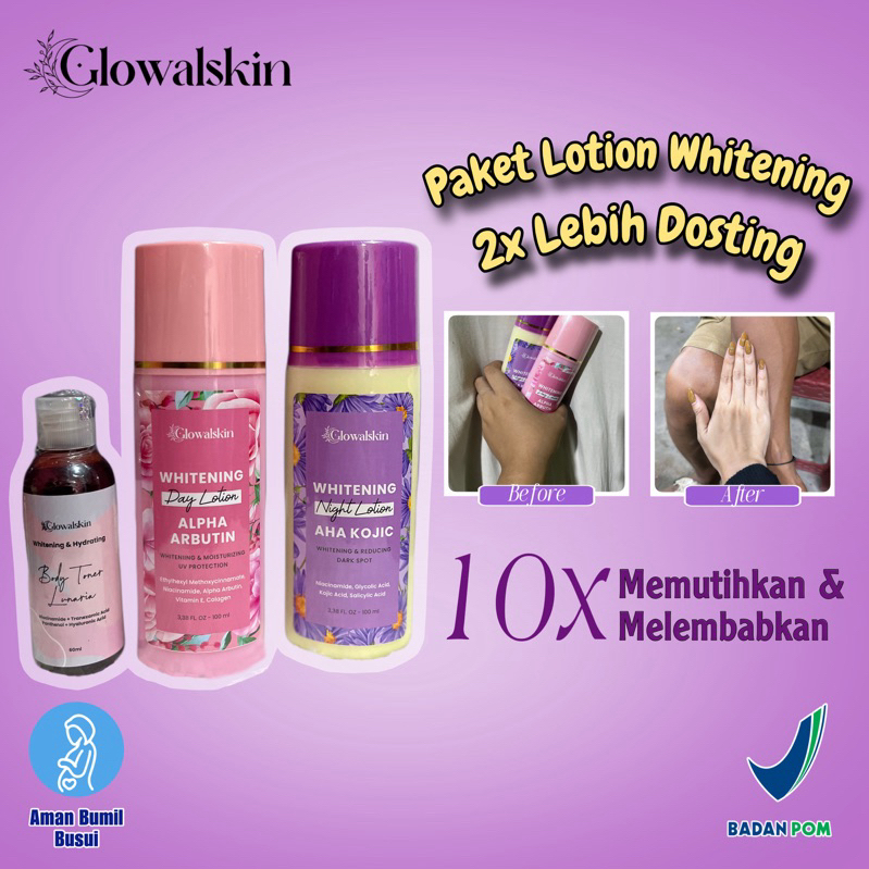 [BPOM] LOTION GLOWALSKIN AHA KOJIC ALPHA ARBUTIN HB DOSTING PEMUTIH BADAN HANDBODY  SUPER DOSTING UN
