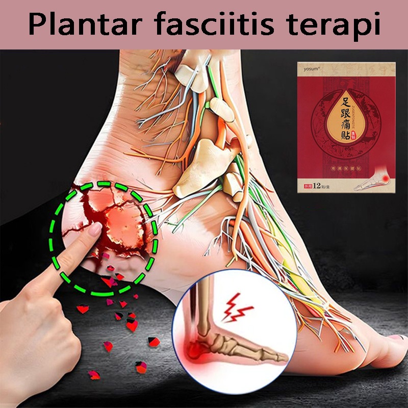 plantar fasciitis terapi koyo kaki pereda nyeri obat sakit tumit pereda kebas kesemutan koyo pereda 
