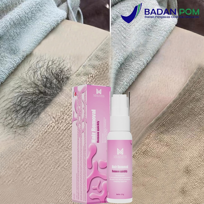 RB Perontok bulu kemaluan perontok bulu permanen cukuran bulu kemaluan perontok bulu ketiak 20ml