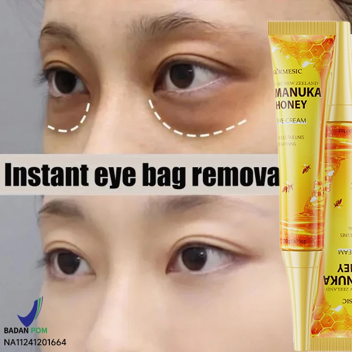 Eye Cream Manuka Honey 20g Penghilang Mata Panda Ampuh Eye Cream Anti Aging Eye Treatment Untuk Ling
