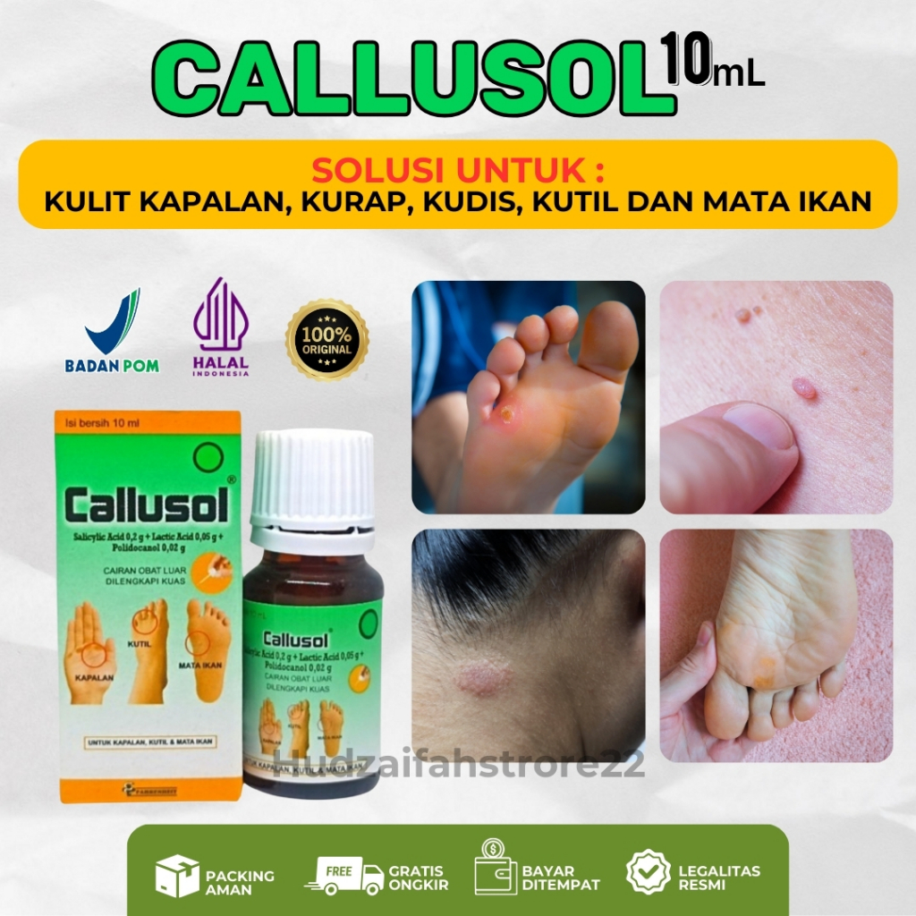 Kalusol Callusol 10ml Untuk Mata Ikan Kapalan di Kaki Tangan Wajah Badan Salep Penghilang Plester Pe