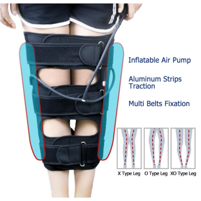 Alat Bantu Terapi Meluruskan Kaki X O /Aldult pelurus kaki /alat terapi kaki o/Untuk Dewasa Leg Corr