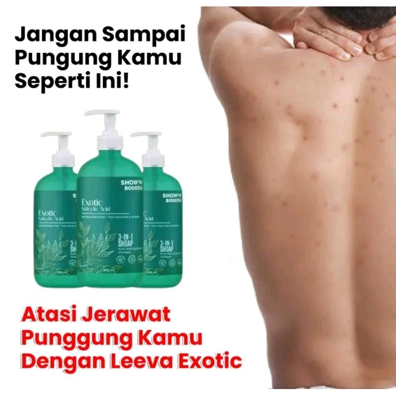 Sabun Leeva Sabun Menghilangkan Gatal Panu Jerawat