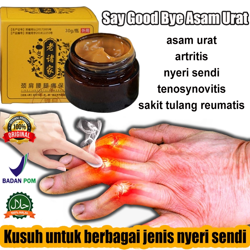 【COD ORI】Obat asam urat Salep asam urat Joint Pain Relief 30g herbal Salep asam urat Paling Ampuh/Ny