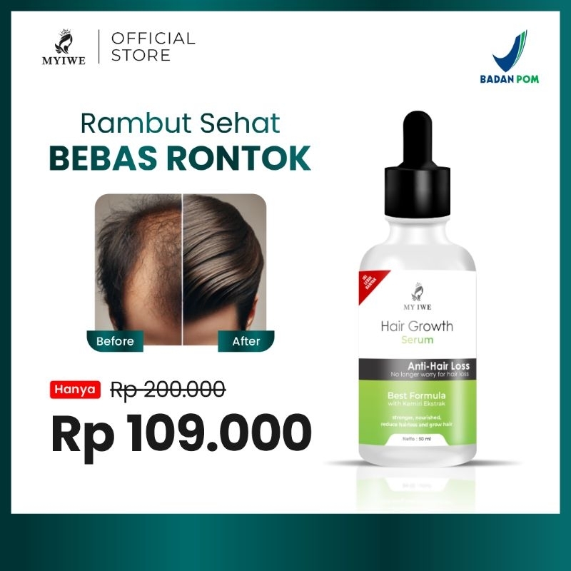 MYIWE Hair Growth Serum Penumbuh Rambut Untuk Rambut Rontok
