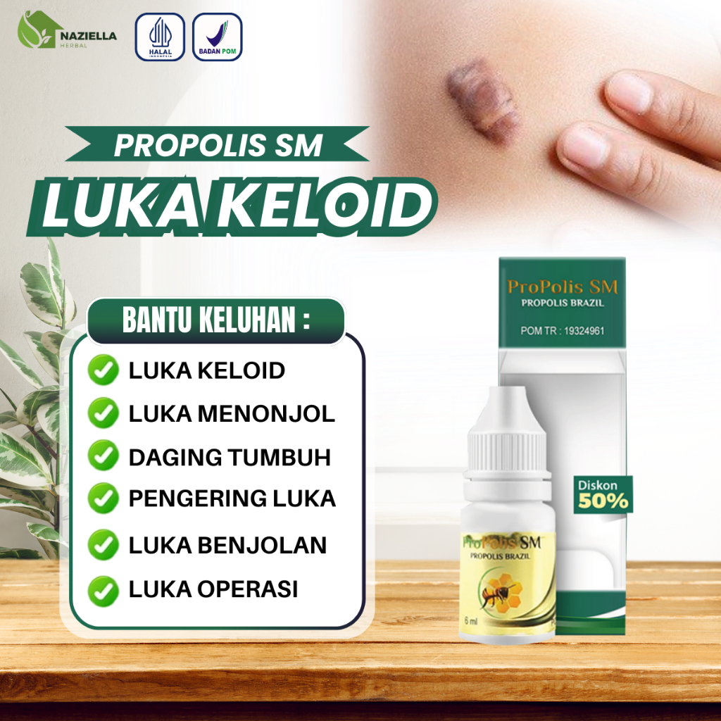 Herbal Untuk Benjolan Tiroid Lipoma Kelenjar di Tubuh Benjolan Uci Uci Penghilang Bekas Luka Pengemp