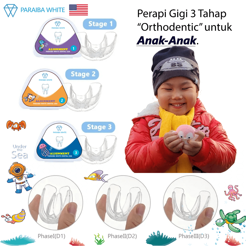 Perapi Gigi Anak – Kids Teeth Trainer Allignment – Orthodentic Retainer Anak – Behel Kawat Gigi Tran
