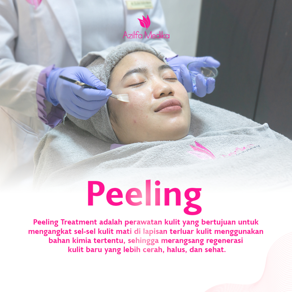 Peeling Voucher Treatment Azilfa Medika