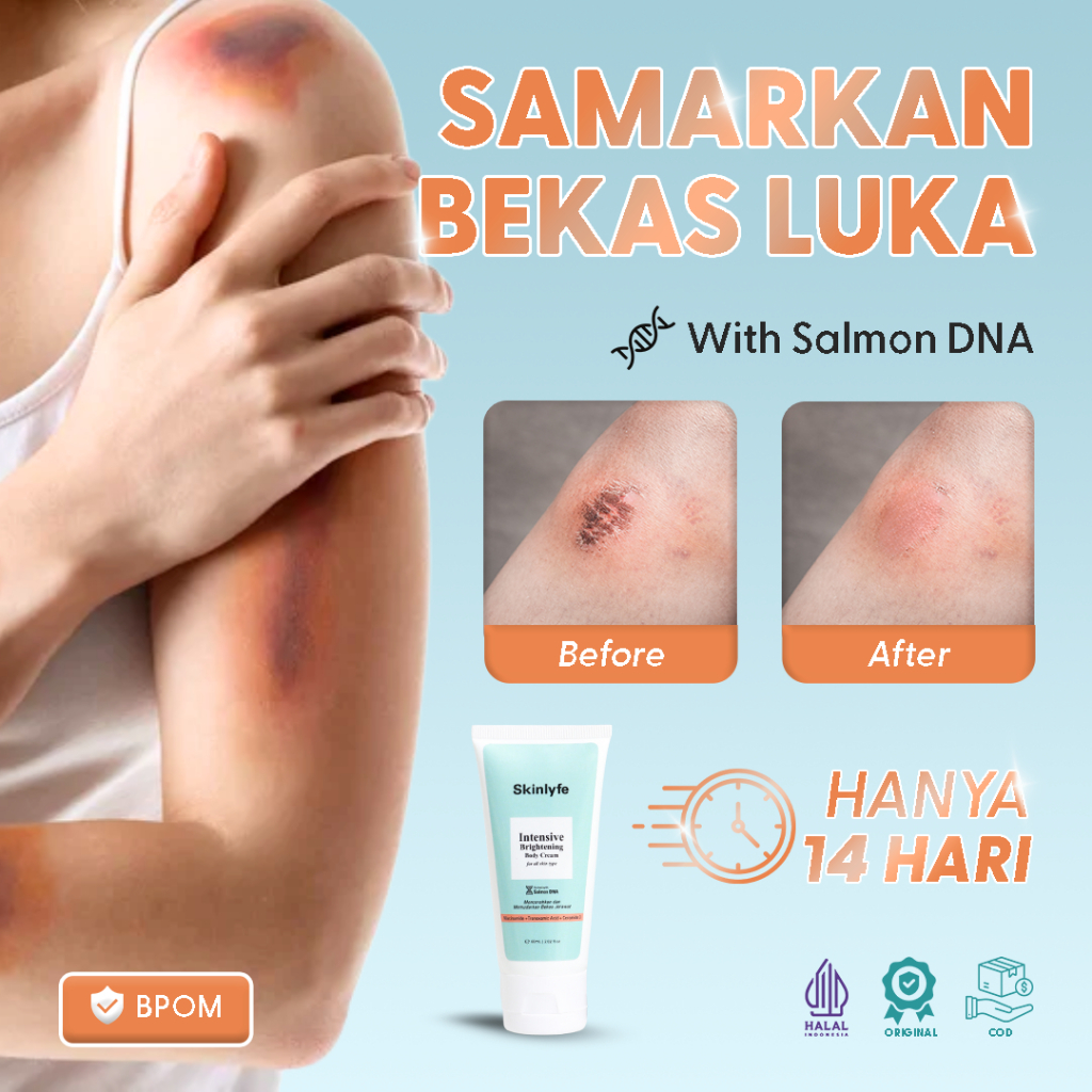 Skinlyfe Penghilang Bekas Luka Menahun Cream Bekas Koreng Cacar Penghilang Strechmark Bopeng BPOM