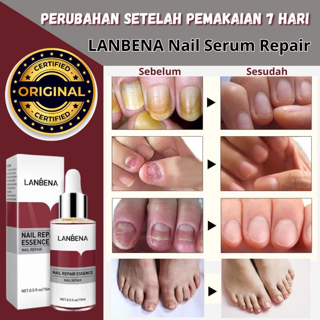 (Original Lanbena) Serum KUKU Lanbena Original Serum Vitamin Perawatan Kuku Rusak Jamuran