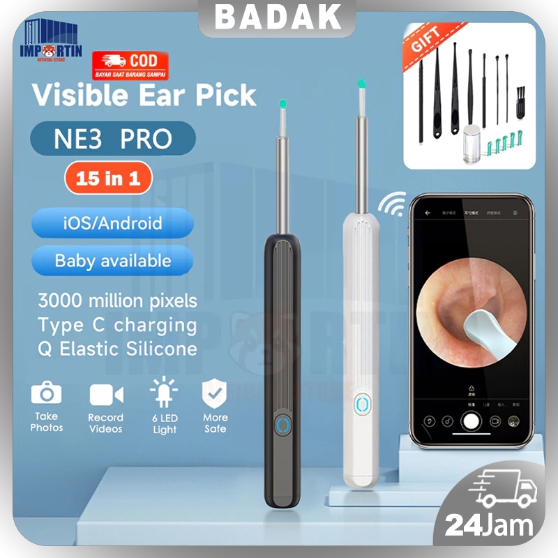 Pembersih telinga bayi korek kuping LED bayi pembersih kuping smart kamera WiFi hp korek kuping