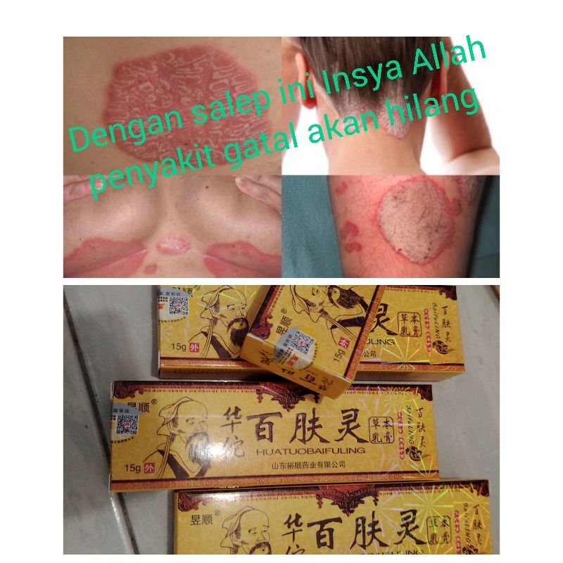 salep gatal cina salep baifuling salep gatal salep caporang tua