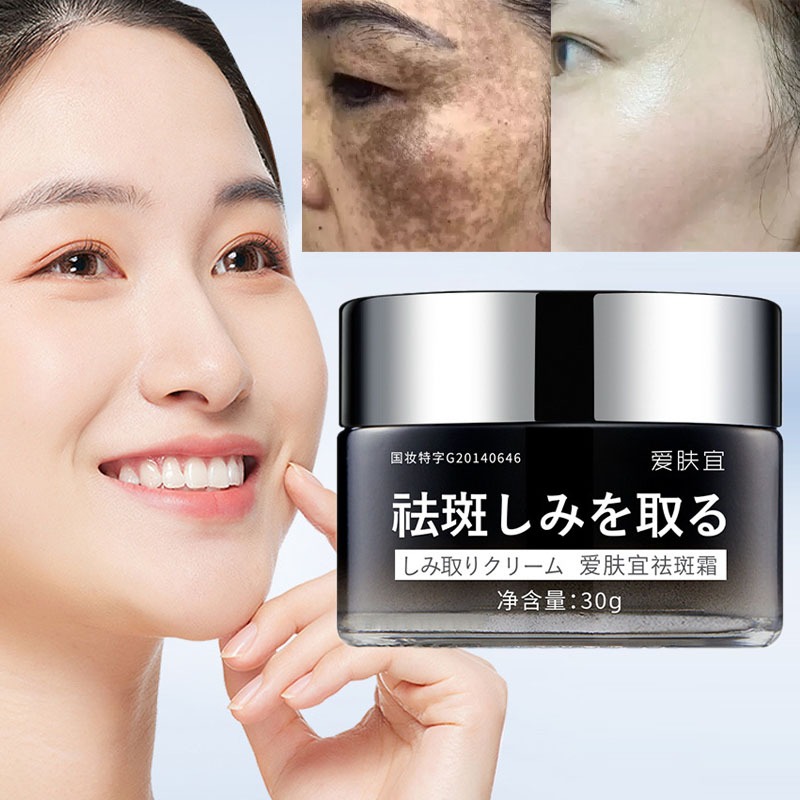 Krim Wajah Penghilang Bintik Hitam Krim Pemutih Memudarkan Bintik Pemutihan Penghilang Flek
