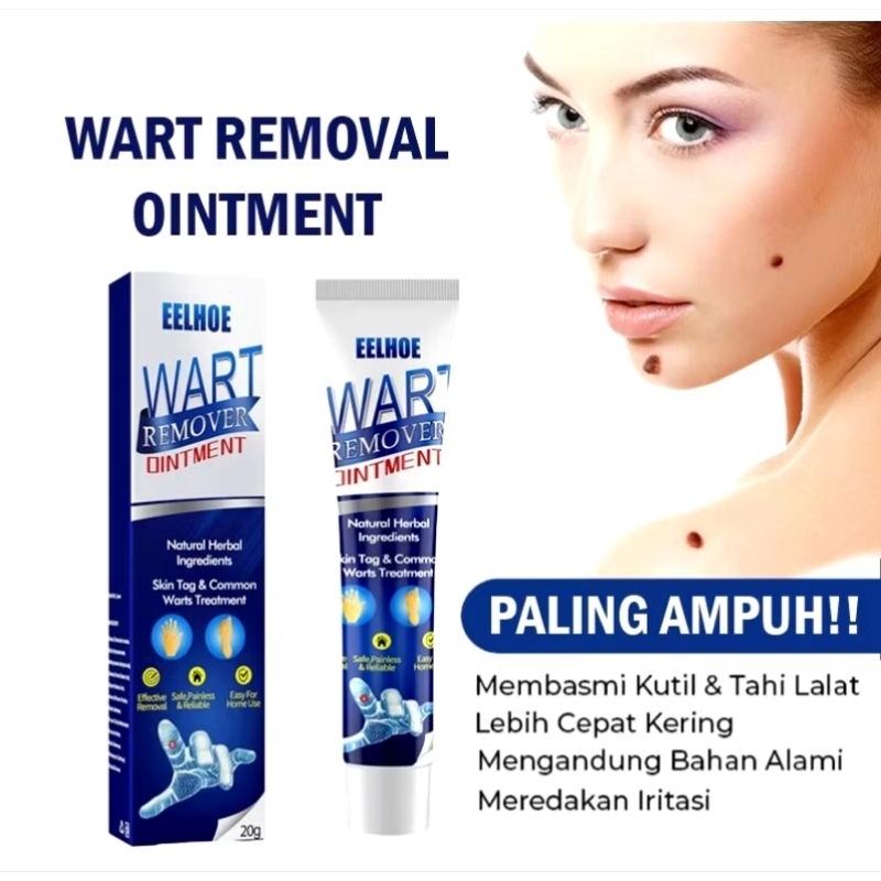 EELHOE Wart Remover Ointment Penghilang KutilSalep Penghilang Tahi Lalat