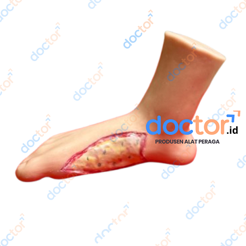 Kaki Luka | Phantom Manikin/Manekin Model Kaki Luka Bahan Silikon Media Praktik Edukasi