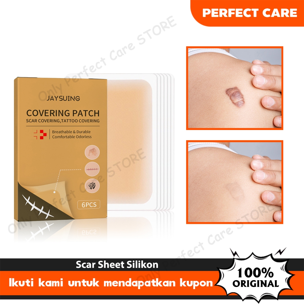Jaysuing Scar Sheet Silikon 6pcs Covering Patch Tato Koyo Kulit Palsu Penutup Bekas Luka Tato Keloid