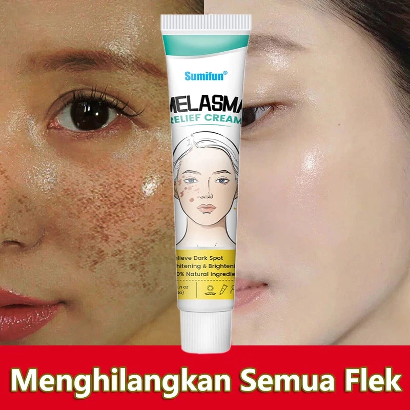 Whitening Freckle Cream 20g Menghilangkan flek hitam di wajah Serum flek hitam membandel Salep flek 