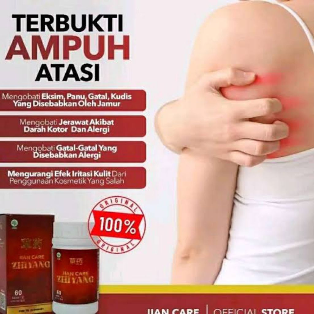 Jian Care Zhiyang - Obat Herbal Cina Mengatasi Gatal Pada Kulit Alergi Biduran Kurap Isi 60 Kapsul