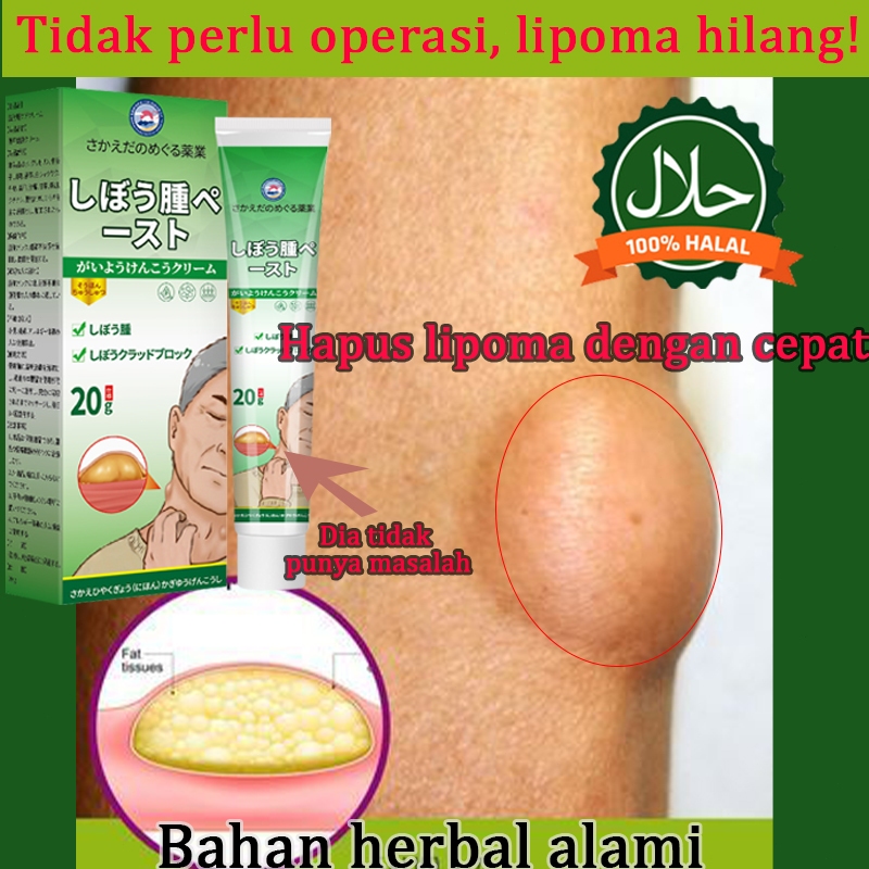 Lipoma Cream - Lipoma Cream Asli - Lipoma Cream - Obat Lipoma - Lipoma Cream Paling Ampuh 20g Cepat 