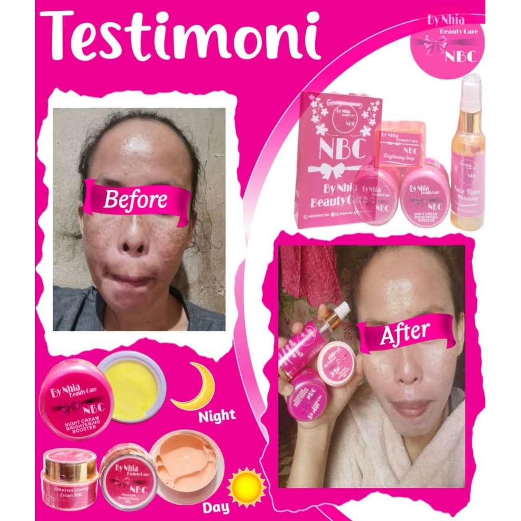 sepaket perawatan wajah berflek, jerawat, dan kusam (NBC skincare ORI)