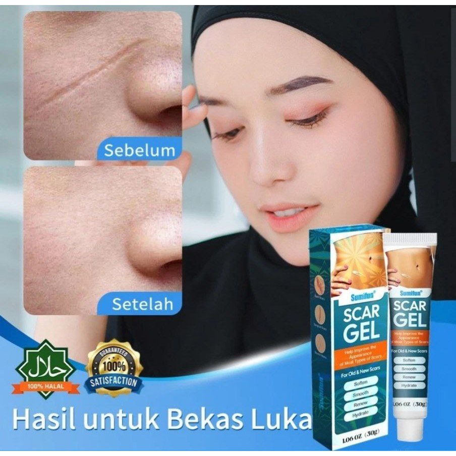 Scar gell penghilang bekas luka scar removal cream
