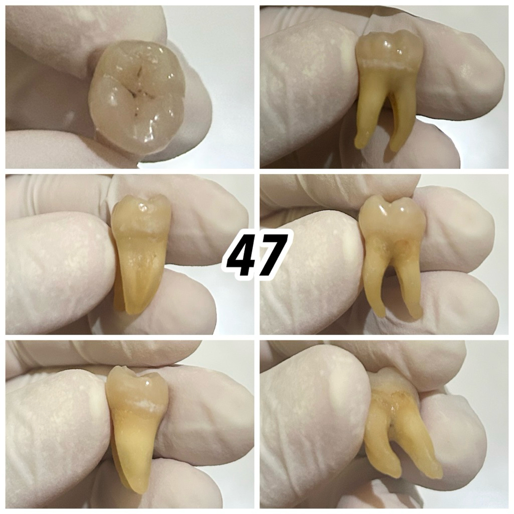 JUAL GIGI ASLI PRAKTIKUM / GIGI MANUSIA / KEDOKTERAN GIGI