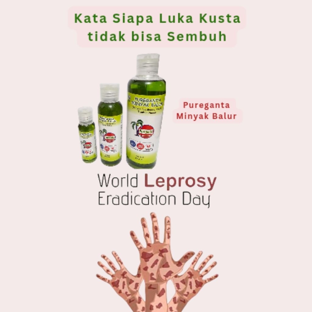 Obat untuk Luka Kusta Lepra dan obat luka lepra, obat luka kudis, obat luka penyembuh luka kusta,sal