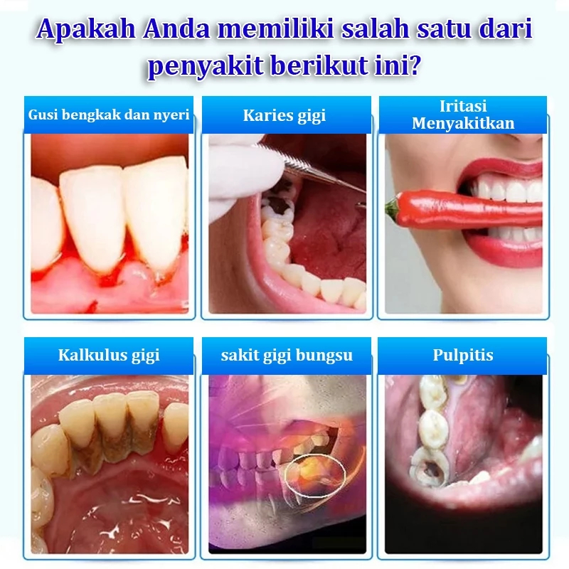 20ml OriObat Sakit Gigi Semprotan Pereda Nyeri Sakit Gigi Pereda Sakit Gigi Semprot Oral Sakit Gigi