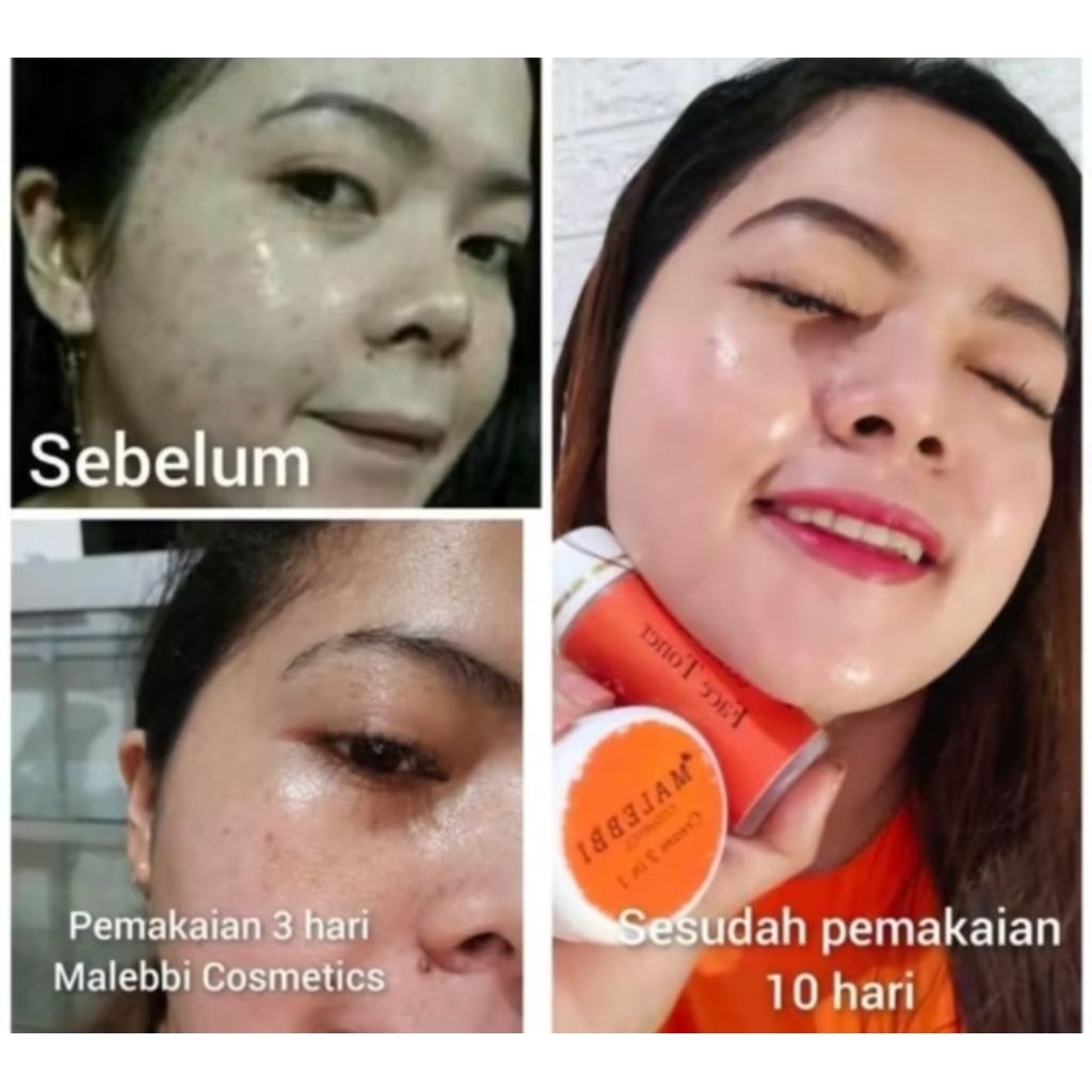 Paketan Cream Malebbi+ Henbodi malebbi Cosmetics Pemutih wajah ampuh flek membandel cream jerawat sa