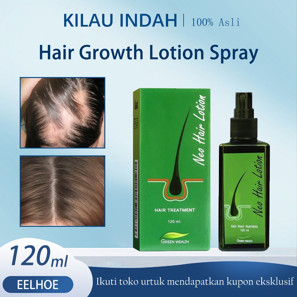 EELHOE Cepat Hair Growth Spray 120ml - Rambut Serum Penumbuh/Esensi Penumbuh Rambut/Penumbuh Rambut/