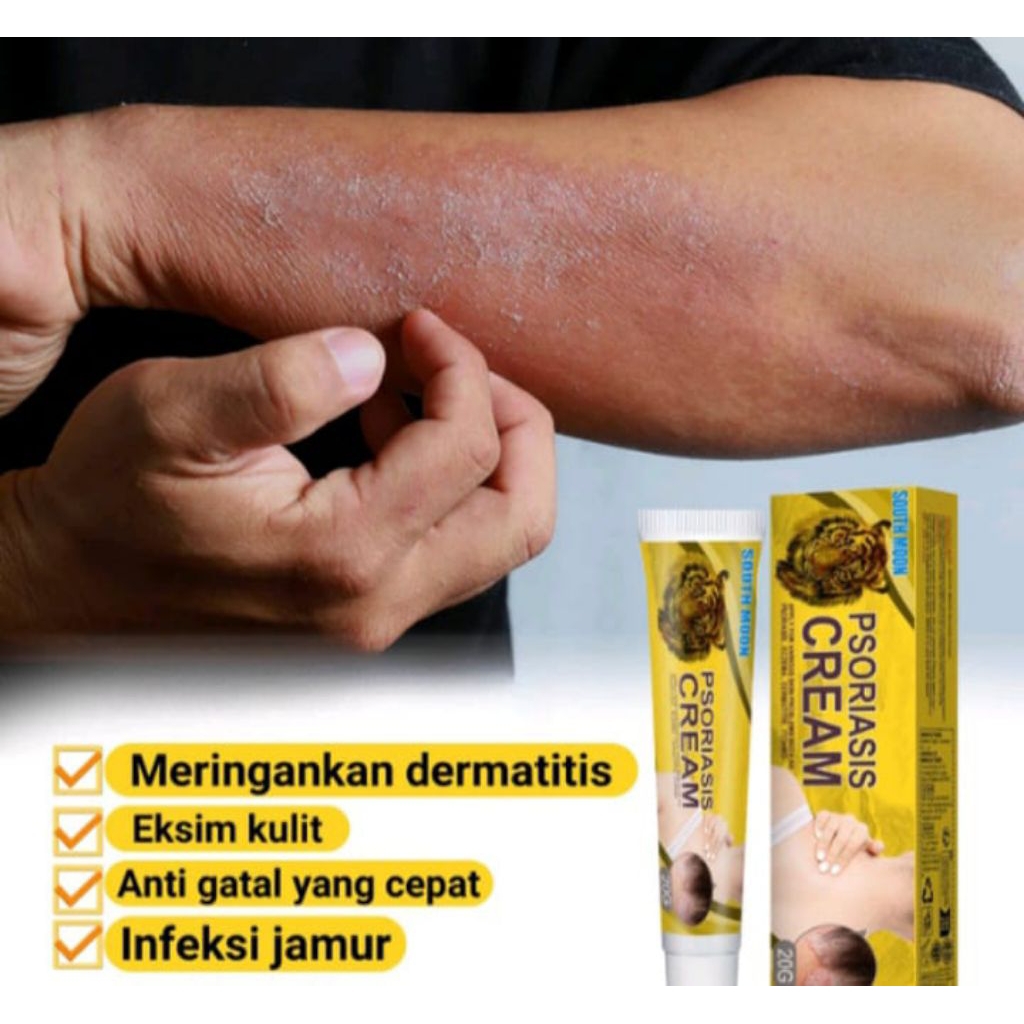 salep psoriosis gatal gatal kulit eksim kering dan psoriosis