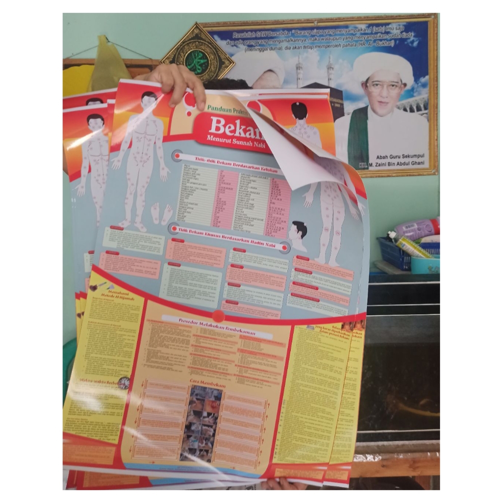 Poster Titik Bekam, Poster Panduan Bekam, Poster Dasar Bekam