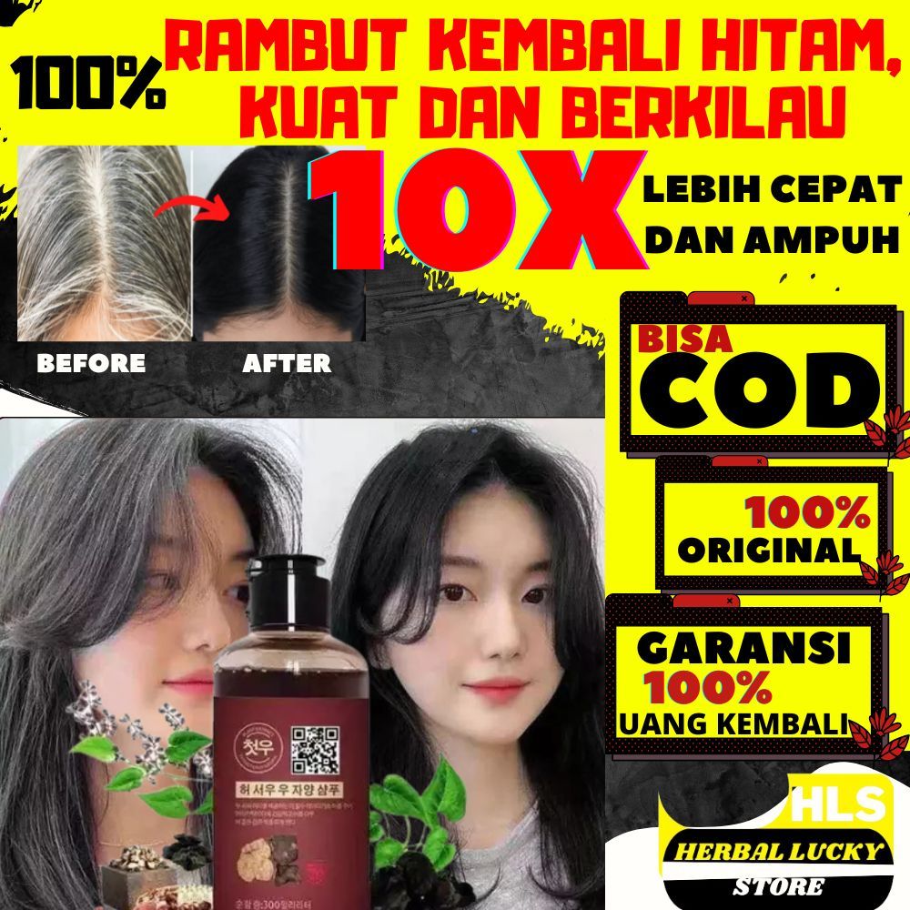 SHAMPO SHAMPOO UBAN PENGHILANG UBAN 300ML PENGHITAM RAMBUT PERMANEN PENGHILANG UBAN GINSENG BLACK CU