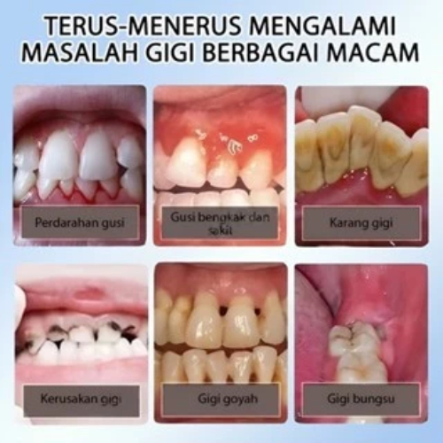 Pasta Gigi Pemutih Menghilangkan Karang Gigi Pemutih Gigi 100% Asli Pemutih Gigi Pasta Gigi Pemutih