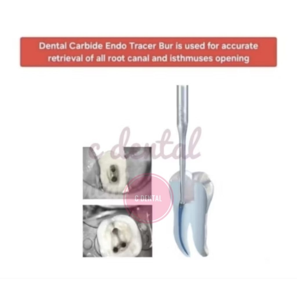 Dental Endo Orifice Tracer Bur Carbide Long Shank Opening Access Root Canal