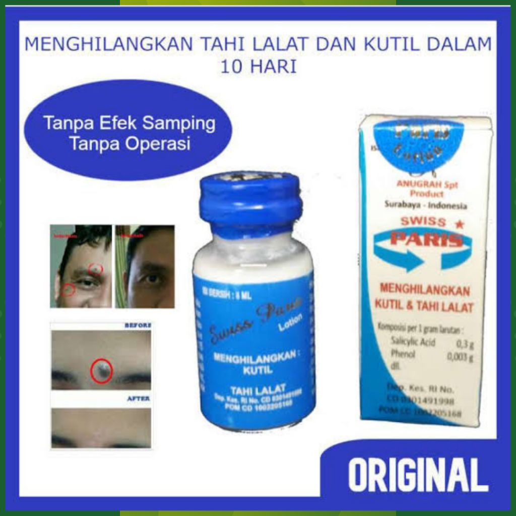 Asli 100% Penghilang Tahi Lalat Kutil Mata Ikan Tanpa Operasi