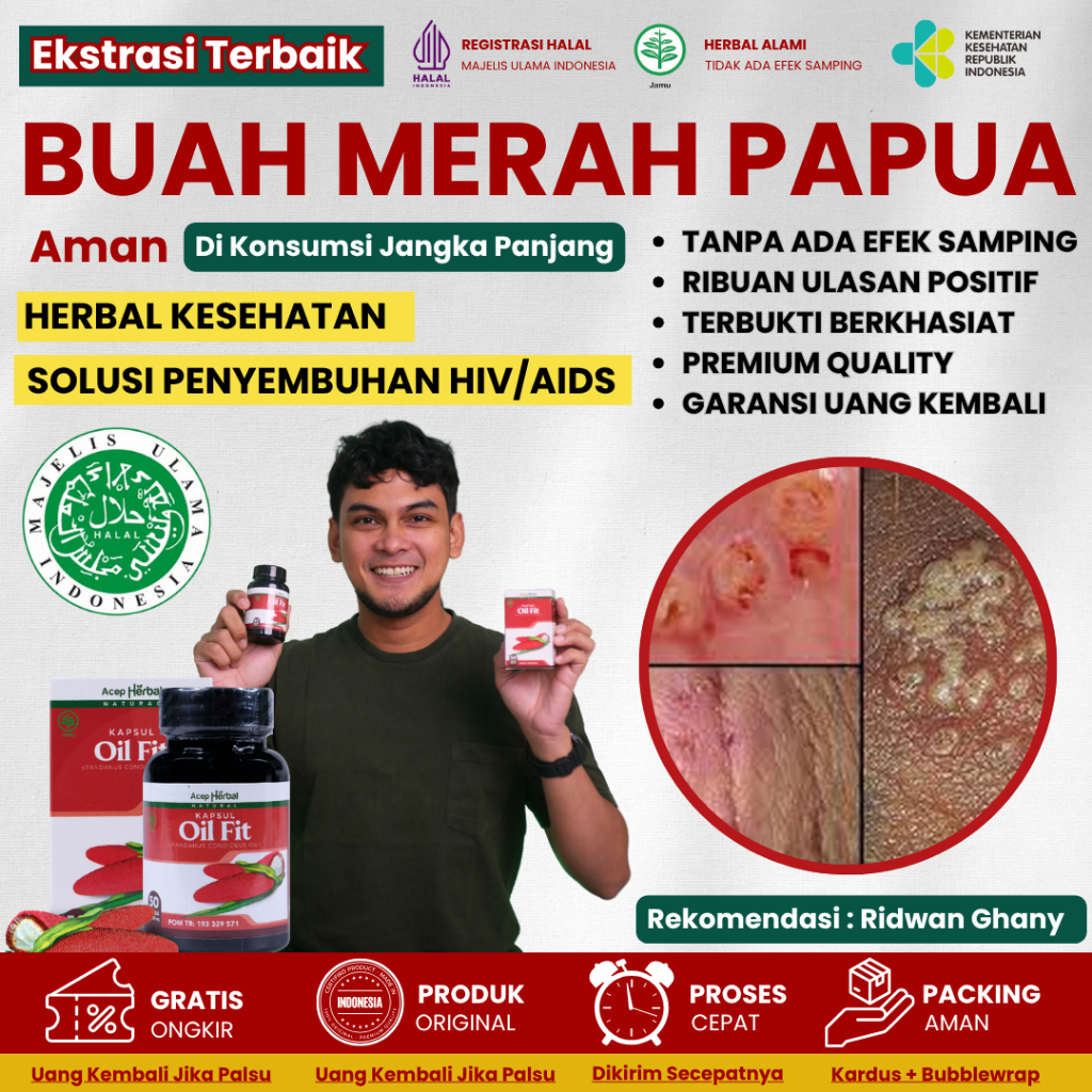 Obat Khusus HIV AIDS, Obat Herbal Gejala HIV AIDS Untuk Pria & Wanita, Obat HIV Sembuh Total Aids HI