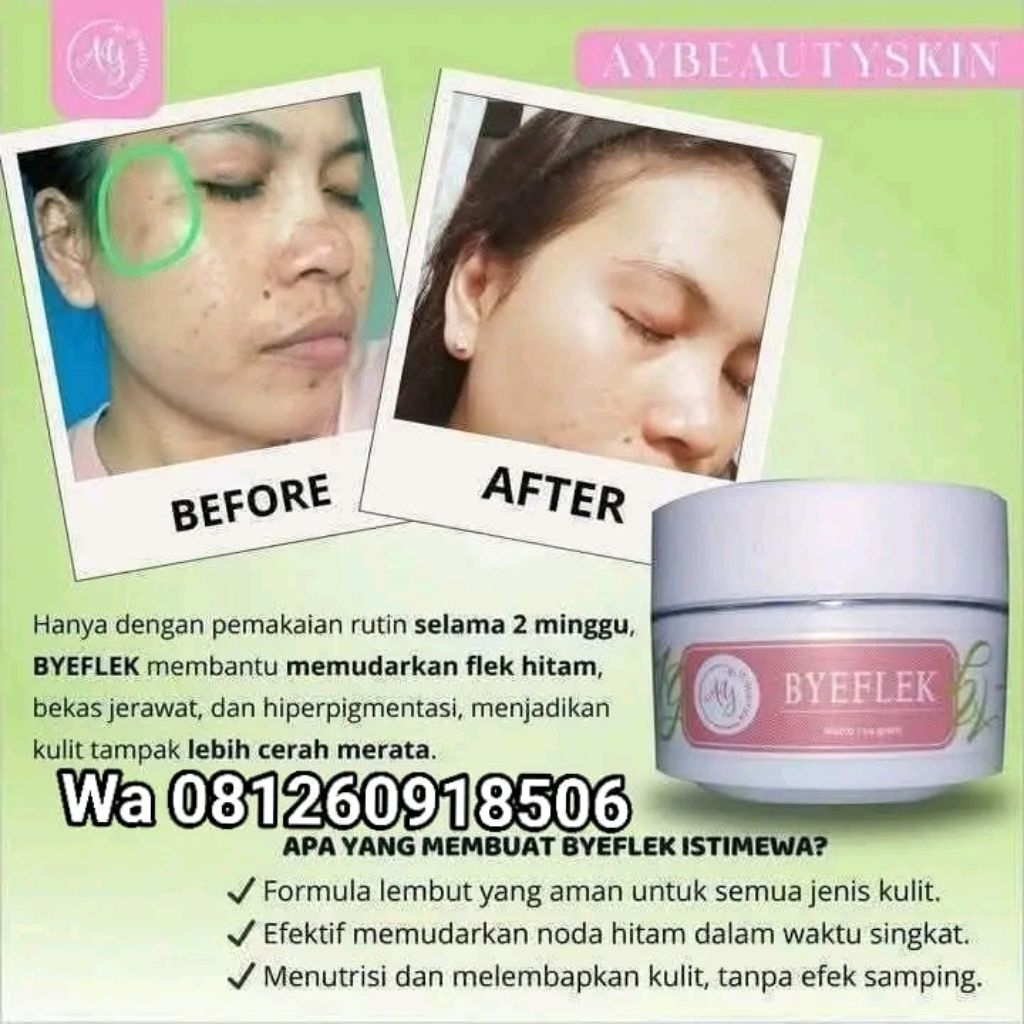 (COD)CREAM FLEK AY BEAUTY BPOM