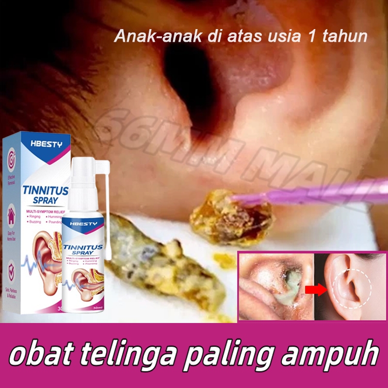 obat tetes telinga Cairan Pembersih Telinga obat sakit telinga Pembersih Kotoran Telinga obat teling
